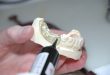 Prothèse dentaire chez les seniors: tout ce que vous devez retenir